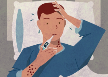 Što učiniti kada ste bolesni | MPOX