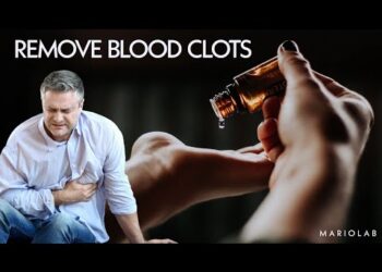 Otkrijte nevjerojatno ulje koje zauvijek mijenja razrjeđivanje krvi!