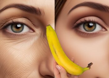 Banana briše sve bore na vašem licu! Vrhunski recepti za starenje