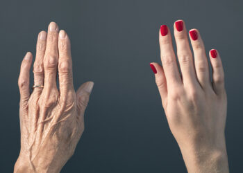 Zbog čega vaša koža postaje naborana s godinama