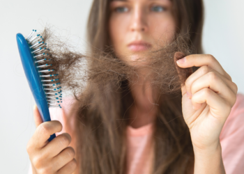 7 vitamina i minerala čiji nedostatak dovodi do ispadanja kose