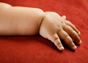 Studija otkriva pacifičku djecu koja se suočavaju s nedostatkom mikronutrijenata i pretilošću