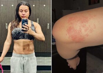 Maryland teretana već tjednima ne radi s ‘intenzivnim i jakim’ ringworm-om jer nije poduzela ovu stvar.