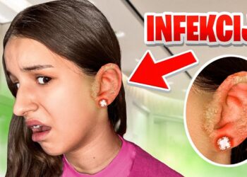 VANESI SE INFICIRALO UHO JER GA JE PROBUŠILA