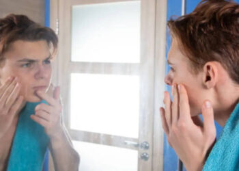 Razlozi za probijanje kože nakon vježbanja u teretani