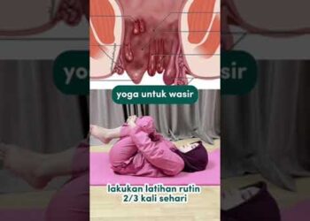 Joga za hemoroide – Medikacare