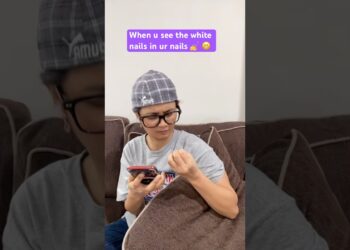 Kad vidite bijele nokte u ur noktima 💅 😁 #smiješni #comedy #fyp シ゚ virusni シ fyp シ゚