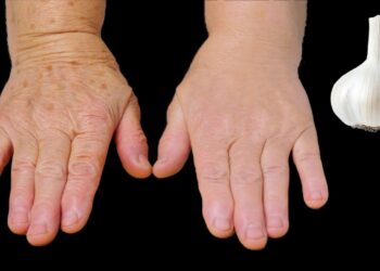 Kolagen pojačanje 🌿 Prijavite se na bore čak i na 70 – moja baka je to učinila, a oni su odmah nestali!