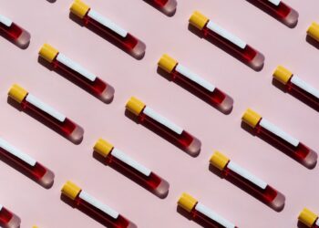 Vrijedi li dubinski i skupi rad krvne plazme?