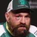 Bori li se Tyson Fury opet? Moguće borbe, uključujući Anthonyja Joshuu.