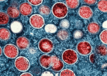 Budite informirani, budite zaštićeni: ključne informacije o MPOX-u