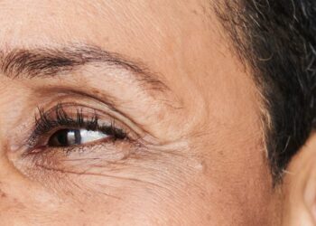 Najbolji savjeti za njegu kože i smanjenje bora za podloge