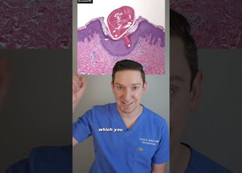 Dermatolog objašnjava keratosis pilaris: što djeluje? #KeratosisPilaris #chickenkin #BumpySkin