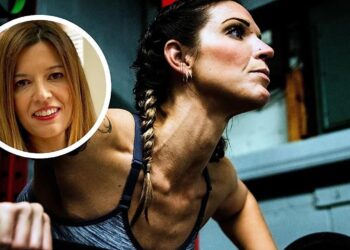 Dermatologinja Ana Molina upozorava: teretana može oštetiti vašu kožu, a da toga niste svjesni