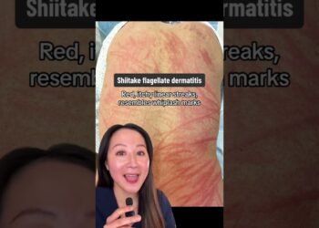 #njega kože #osip #dermatologija #dermatolog #savjeti zanjegu kože #stručnjaci zanjegu kože