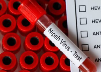 Zapadni Bengal potvrdio 5 slučajeva Nipah virusa, 100 u karanteni; Provjerite simptome i načine zaštite