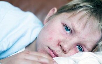 Kako osigurati sigurnost svoje djece tijekom epidemije ospica