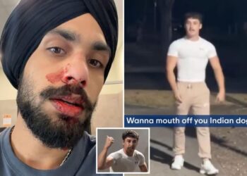 Medicinska sestra zadobila slomljen nos u ‘rasističkom’ napadu iz zasjede u teretani