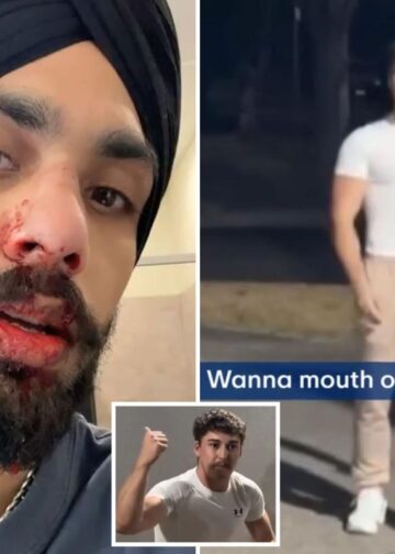 Medicinska sestra zadobila slomljen nos u ‘rasističkom’ napadu iz zasjede u teretani