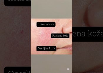 Najbolje za iritiranu, upaljenu i osetljivu kožu! 😃