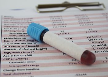 ‘Kardiolog otkriva—nepoznati test kolesterola koji može spriječiti bolesti srca’