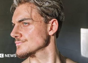 Oblikovanje čeljusti i ocjenjivanje: Unutar svijeta looksmaxxinga