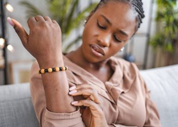 Imate li česte modrice? Zašto bi ovaj uobičajeni simptom mogao biti upozorenje za zdravlje mozga nakon 40. godine