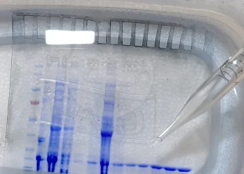 Visoko mutirana varijanta COVID-a otkrivena u 25 država: Što trebate znati