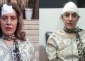 Uzma Kardar teže ozlijeđen tijekom vježbanja u teretani