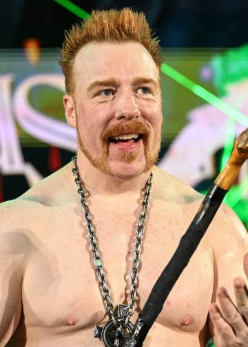 Sheamus dijeli fotografije nakon nesreće u teretani