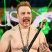 Sheamus dijeli fotografije nakon nesreće u teretani