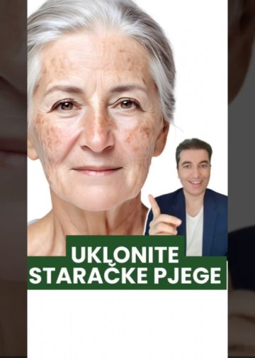 Br. 1 prirodni lijek za staračke mrlje – soda bikarbona čini čuda!