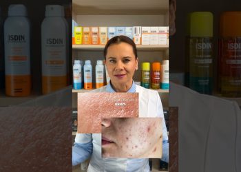 Začepljuje li SPF stvarno pore? ☀️