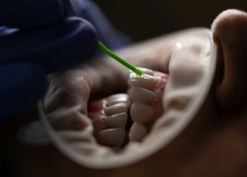 U Hrvatskoj stupaju na snagu nova pravila za stomatološko liječenje