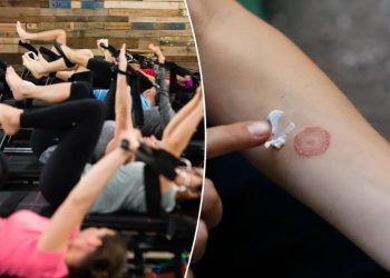Fitnes studio od 46 dolara po satu uzrokuje lišajeve: izvješća