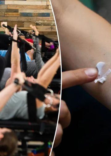 Fitnes studio od 46 dolara po satu uzrokuje lišajeve: izvješća